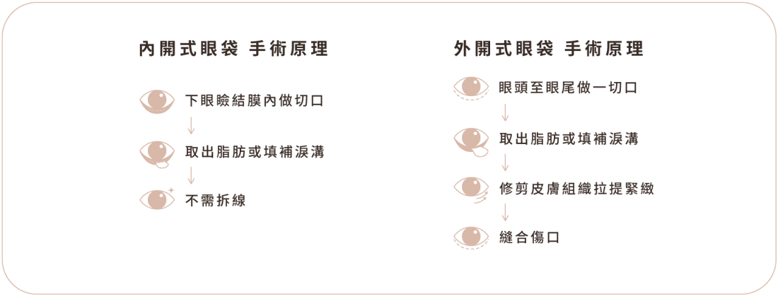 眼袋手術_手術原理.png