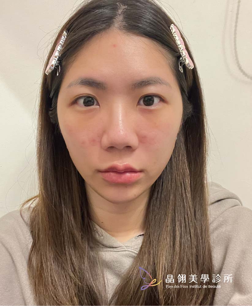 真實分享|擺脫眼袋困擾,重拾清新精神感_工作區域 1 複本 4.jpg