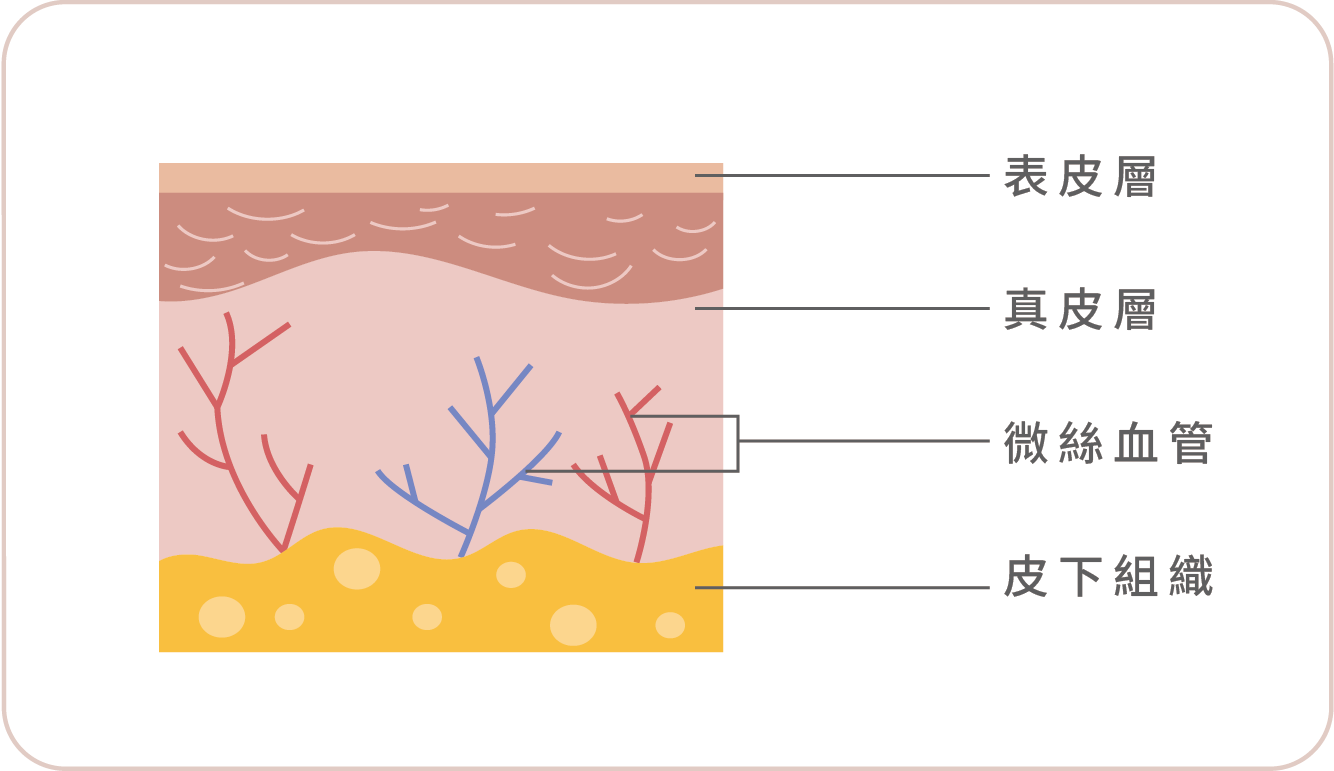 臉頰紅紅好困擾?【血絲治療懶人包】最完整血絲改善攻略|克萊提雷射效果公開-02.png