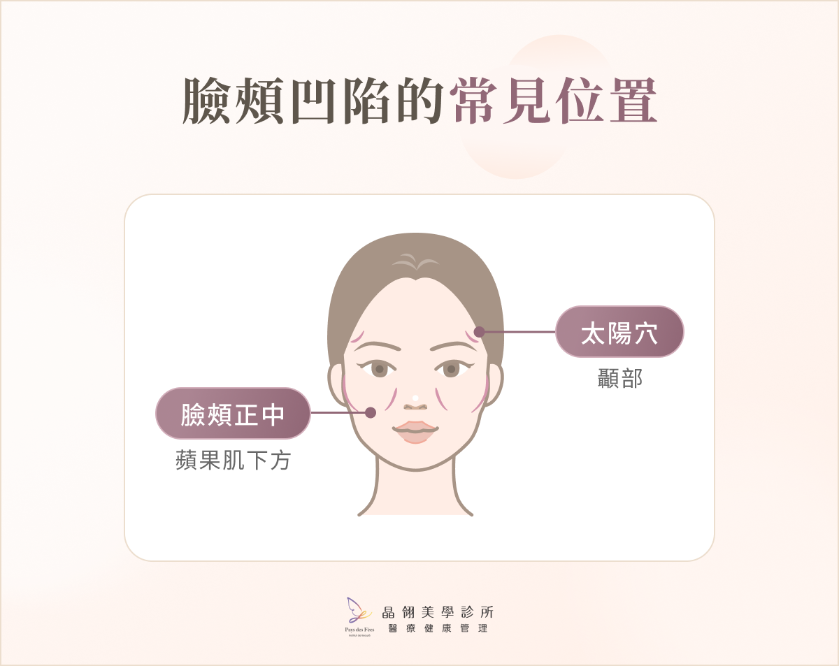 臉頰凹陷的常見位置