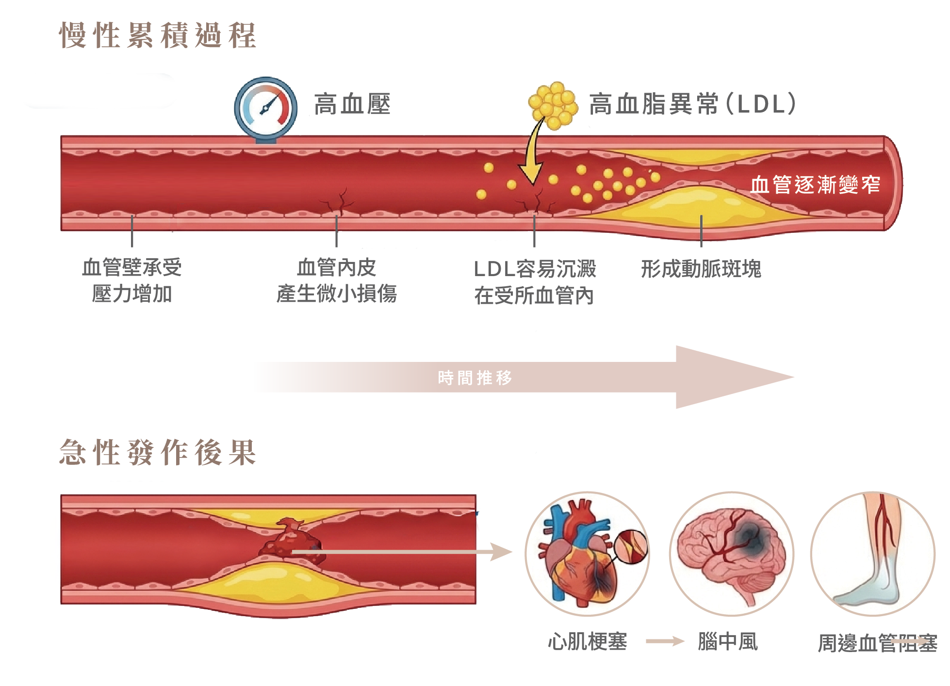 高血壓高血脂心血管健康全攻略:成因、控制方式與風險分級一次搞懂-03.png