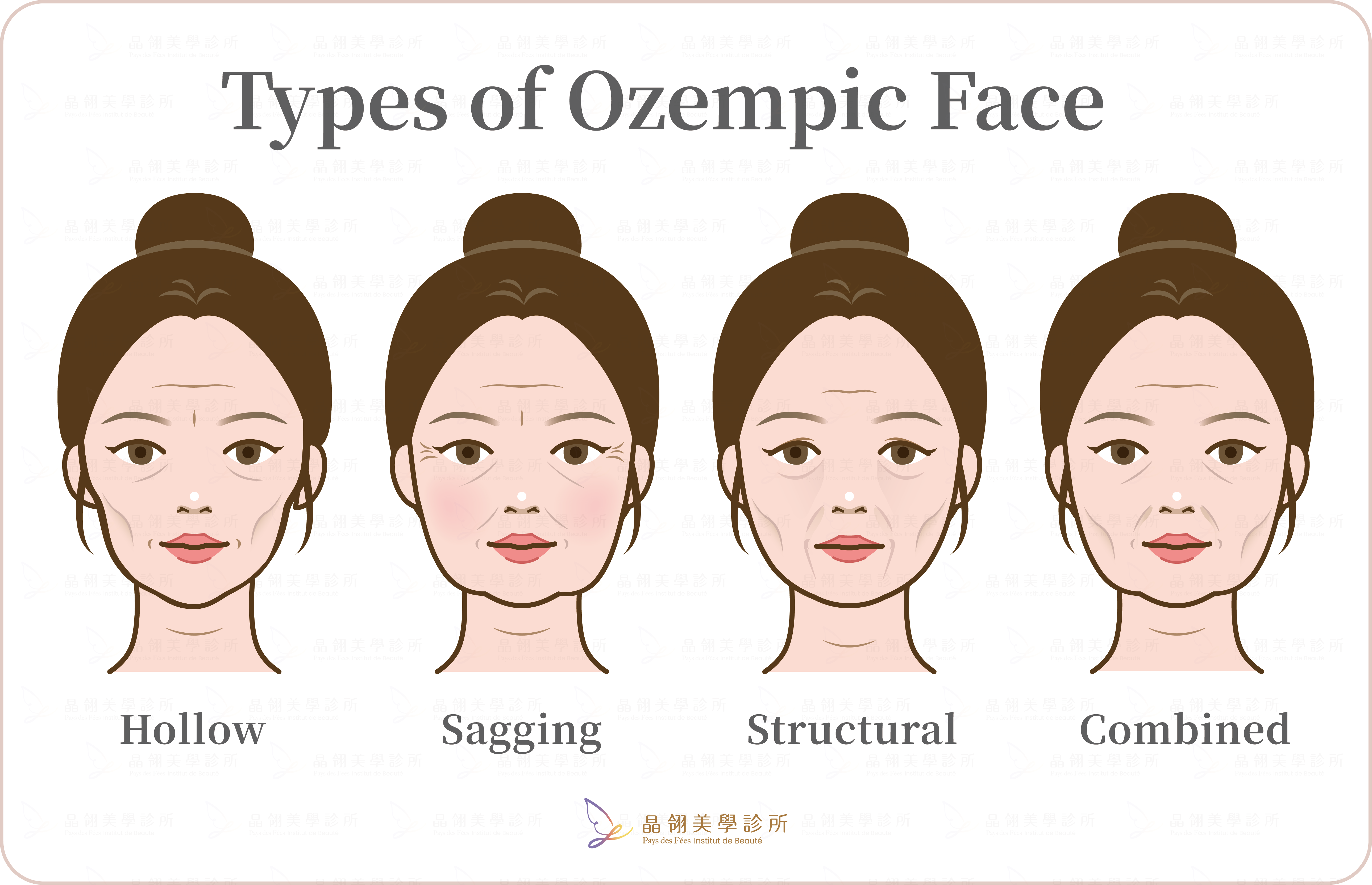 3 Causes of Mounjaro Face-11.png