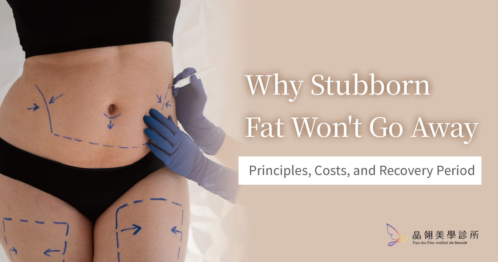 Why Stubborn Fat Won't Go Away_工作區域 1.png