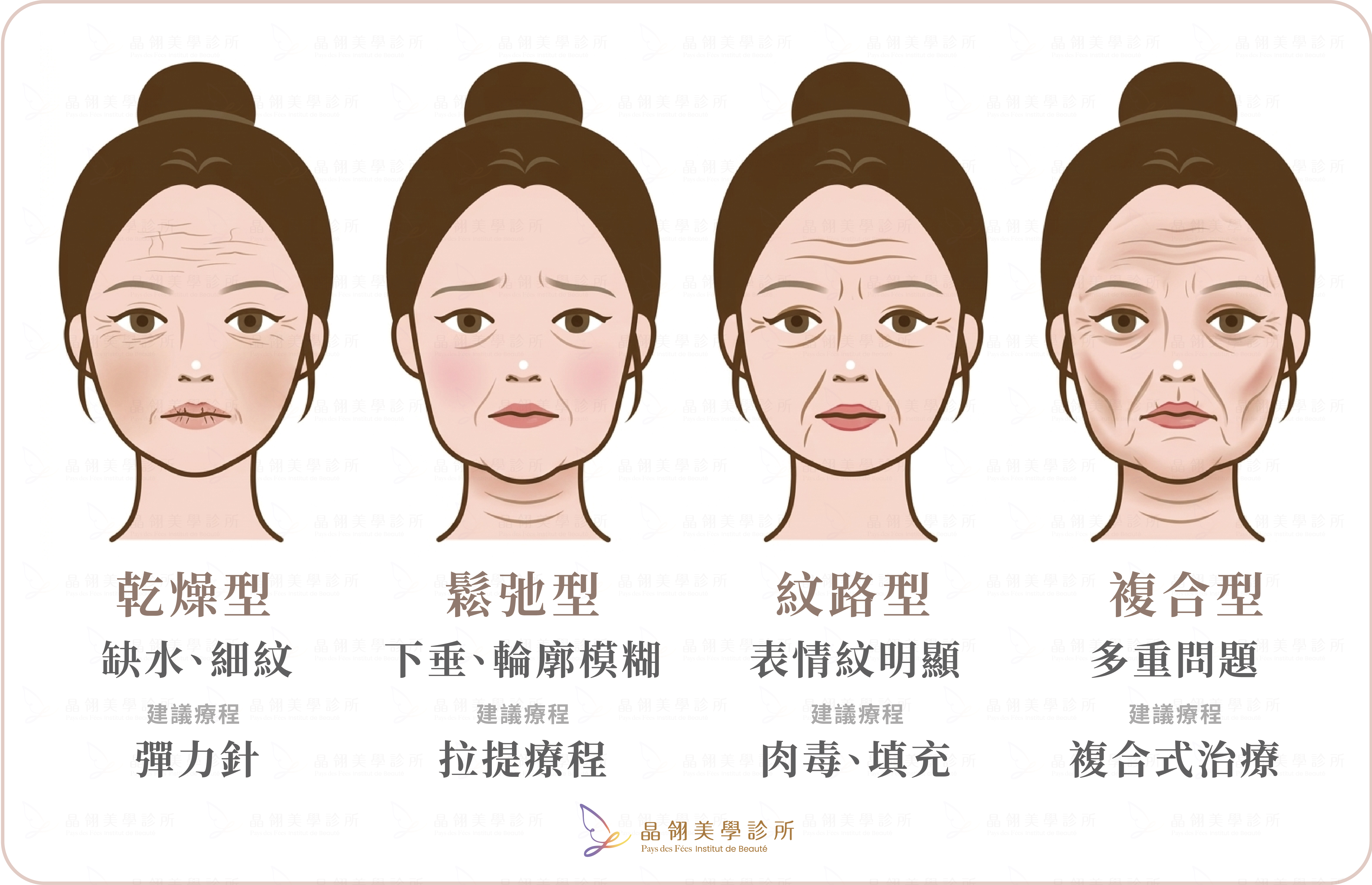彈力針是什麼?效果、維持時間與適合族群完整解析-09.png